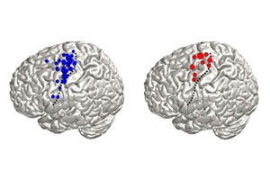 Mapping the Brain