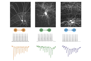 Clever Suppression in the Brain