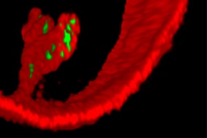 Zipper Triggers Bacterial Invasion 