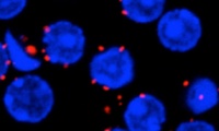 How protein islands form