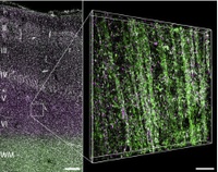 Epilepsy at the Molecular Level 