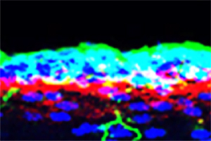 Fewer scars in the central nervous system 