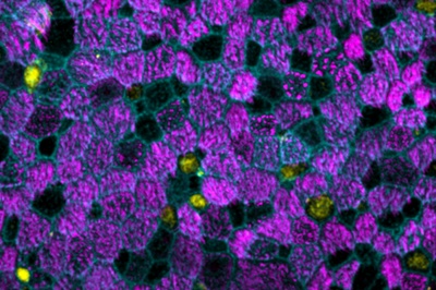 Lung Tissue from the Lab  