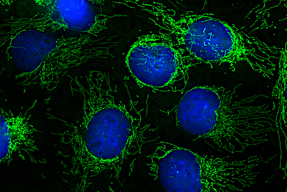 Protein molecules in mitochondria clearly assigned for the first time