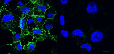 Sugar-based inhibitors disarm the pathogen Pseudomonas aeruginosa