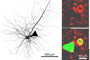 Genetische Grundlage für psychische Erkrankungen