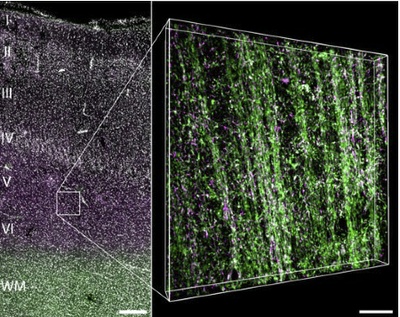 Epilepsie auf molekularer Ebene 