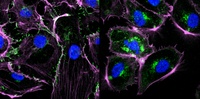 Pseudomonas aeruginosa Bakterien stellen ein Molekül her, das Zellen des Immunsystems lähmt